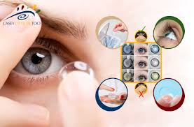 Các loại lens cận phổ biến trên thị trường